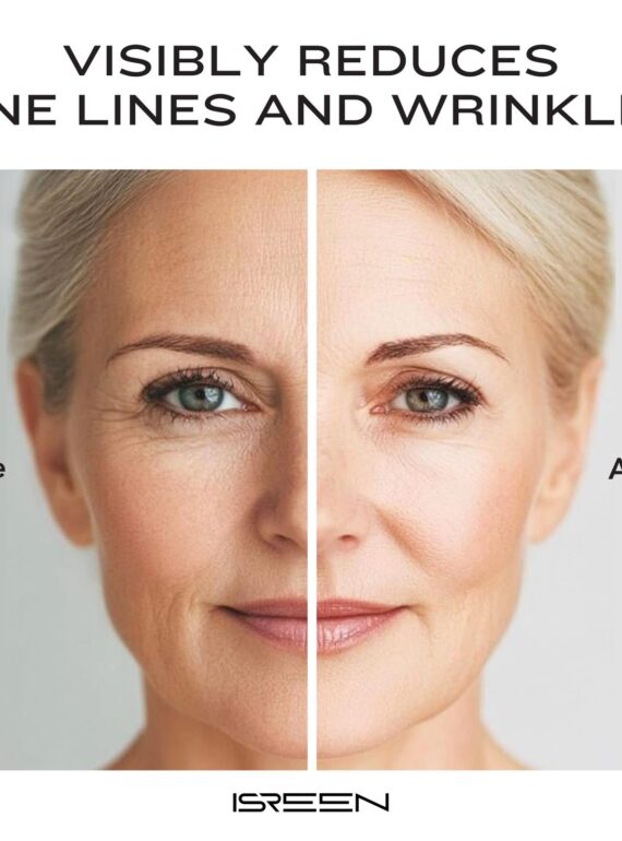 Before and after comparison of a woman’s face showing reduced fine lines and wrinkles after using ISREEN skincare product.