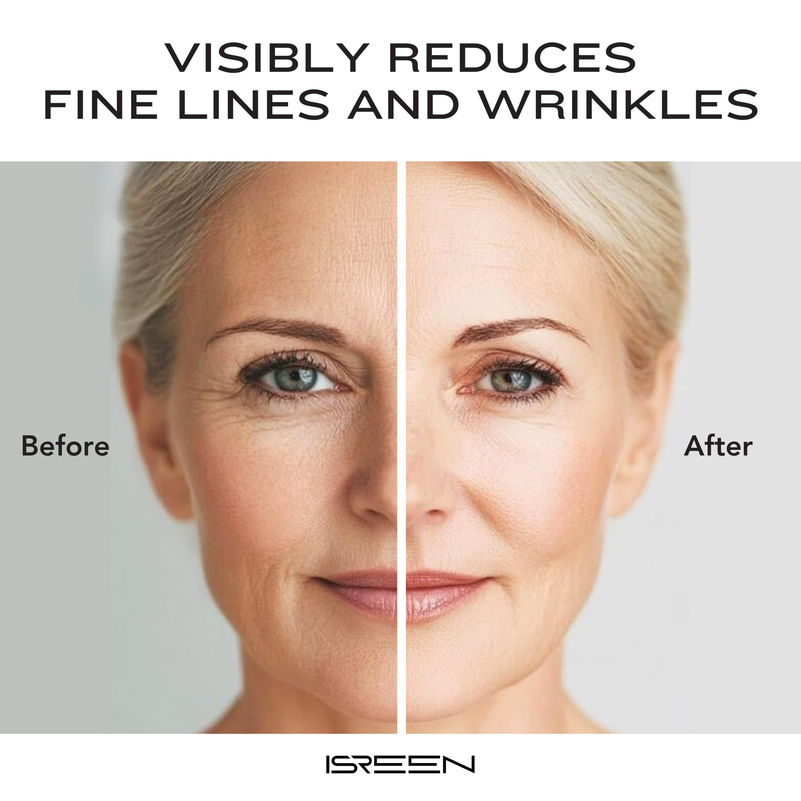 Before and after comparison of a woman’s face showing reduced fine lines and wrinkles after using ISREEN skincare product.